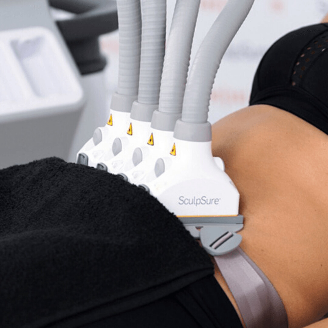 sculpsure_square