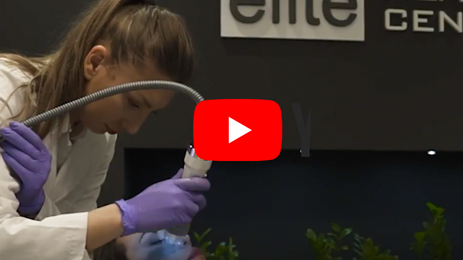 vivace microneelding